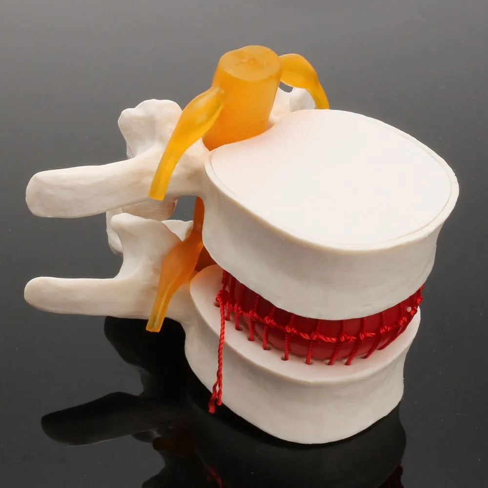 White PVC lumbar intervertebral disc demonstration model for medical anatomy teaching