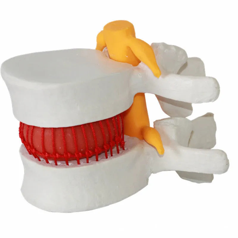 White PVC lumbar intervertebral disc demonstration model for medical anatomy teaching