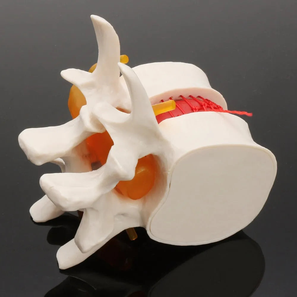 White PVC lumbar intervertebral disc demonstration model for medical anatomy teaching