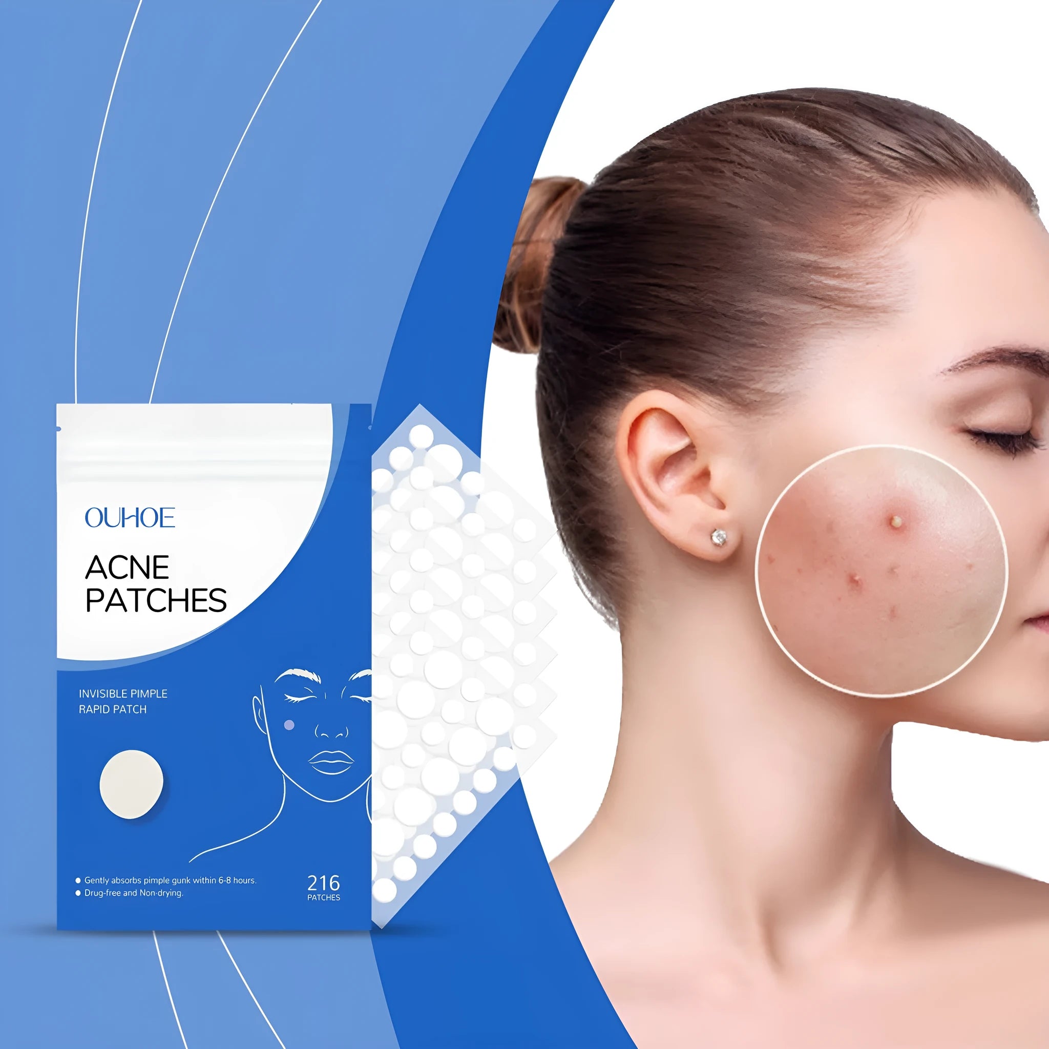 Pack of 216 hydrocolloid acne patches for facial blemish care with tea tree oil and vitamin E.