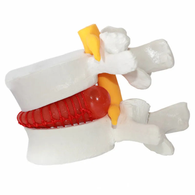 White PVC lumbar intervertebral disc demonstration model for medical anatomy teaching