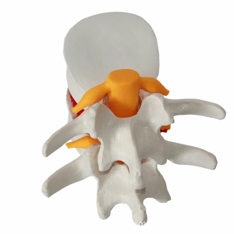 White PVC lumbar intervertebral disc demonstration model for medical anatomy teaching