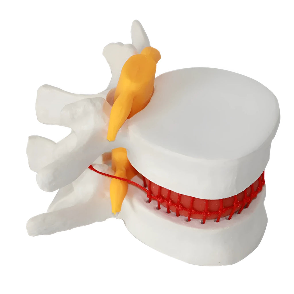 White PVC lumbar intervertebral disc demonstration model for medical anatomy teaching
