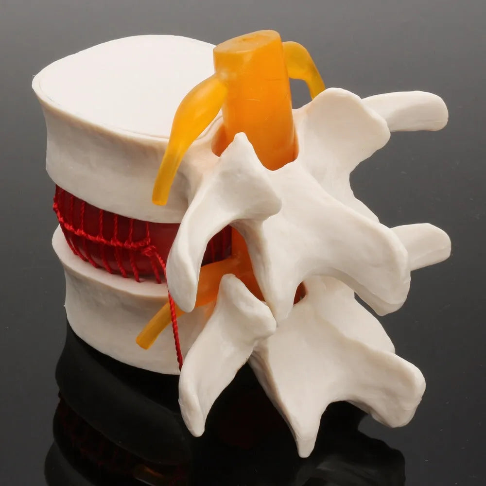 White PVC lumbar intervertebral disc demonstration model for medical anatomy teaching