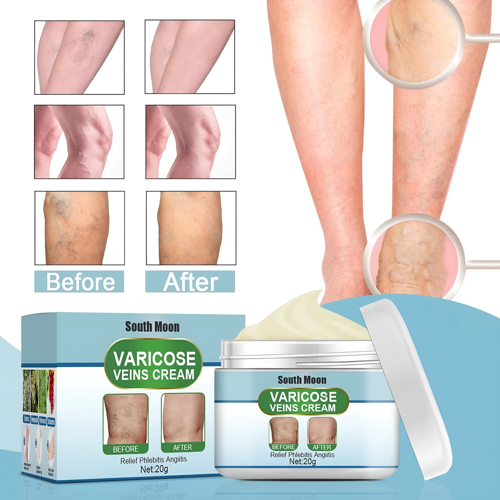 20g vein repair cream container for leg vein relief and green tendon bulge appearance