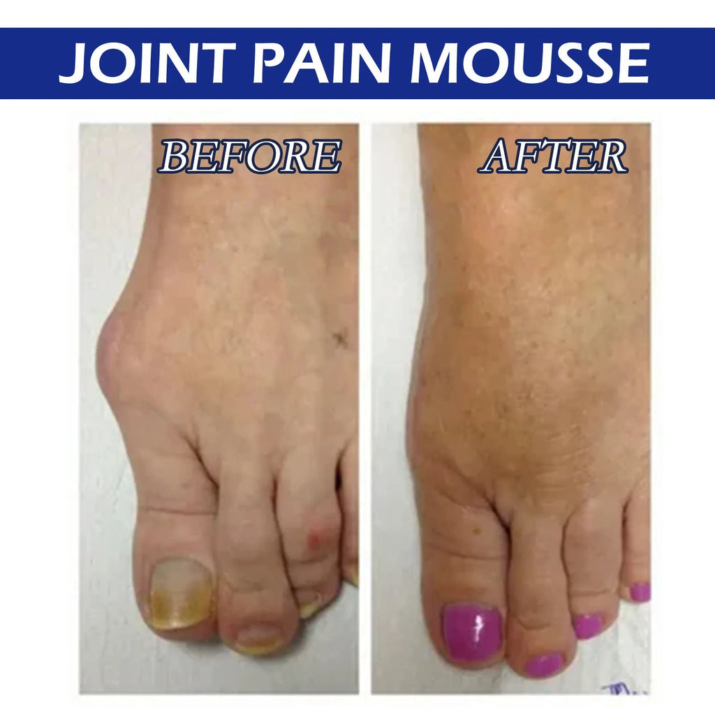 15ml bottle of Herbal Care Drops with roll-on applicator for muscle and joint relief