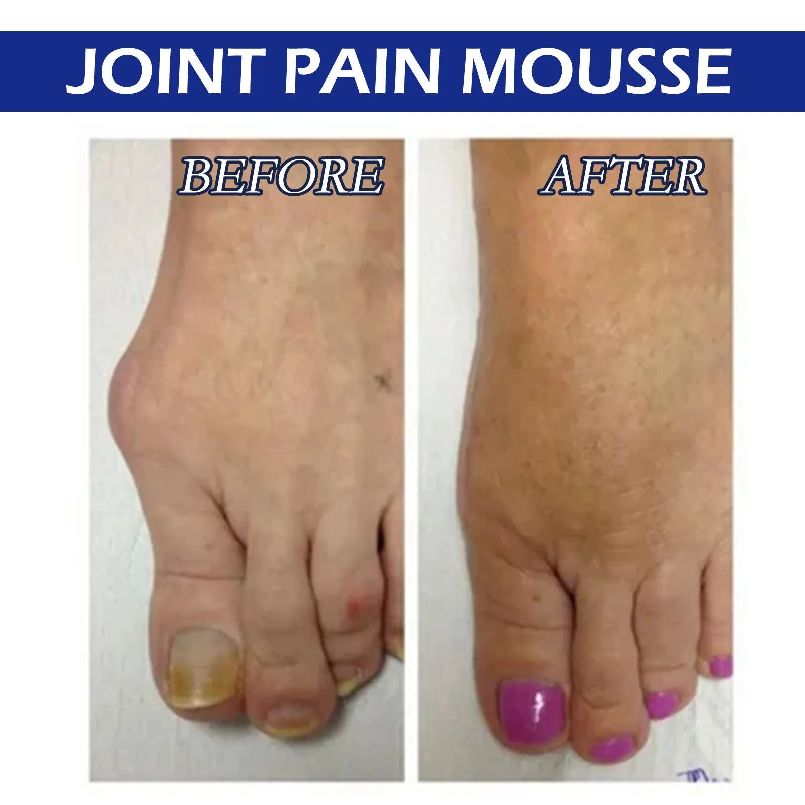 15ml bottle of Herbal Care Drops with roll-on applicator for muscle and joint relief