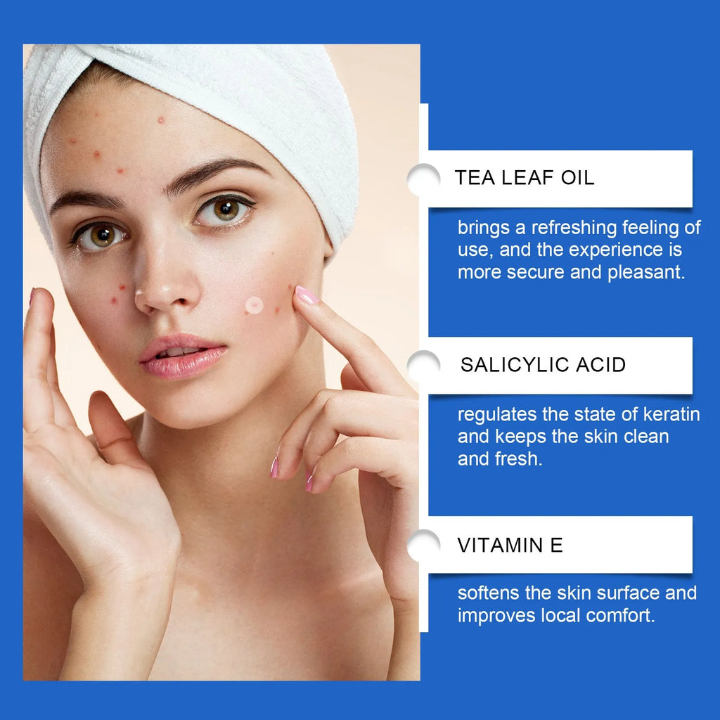 Pack of 216 hydrocolloid acne patches for facial blemish care with tea tree oil and vitamin E.