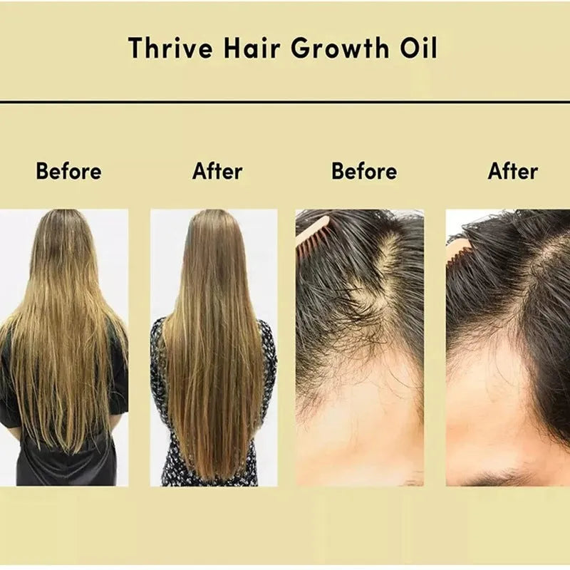 60ml bottle of yellow rosemary hair oil for damaged hair treatment
